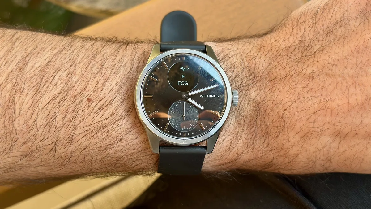 作者手腕上的 Withings ScanWatch 2，在小型 OLED 屏幕上显示 ECG 小部件。